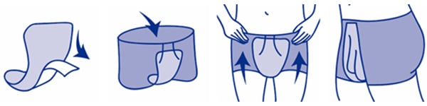 Schéma de pose d’une protection anatomique