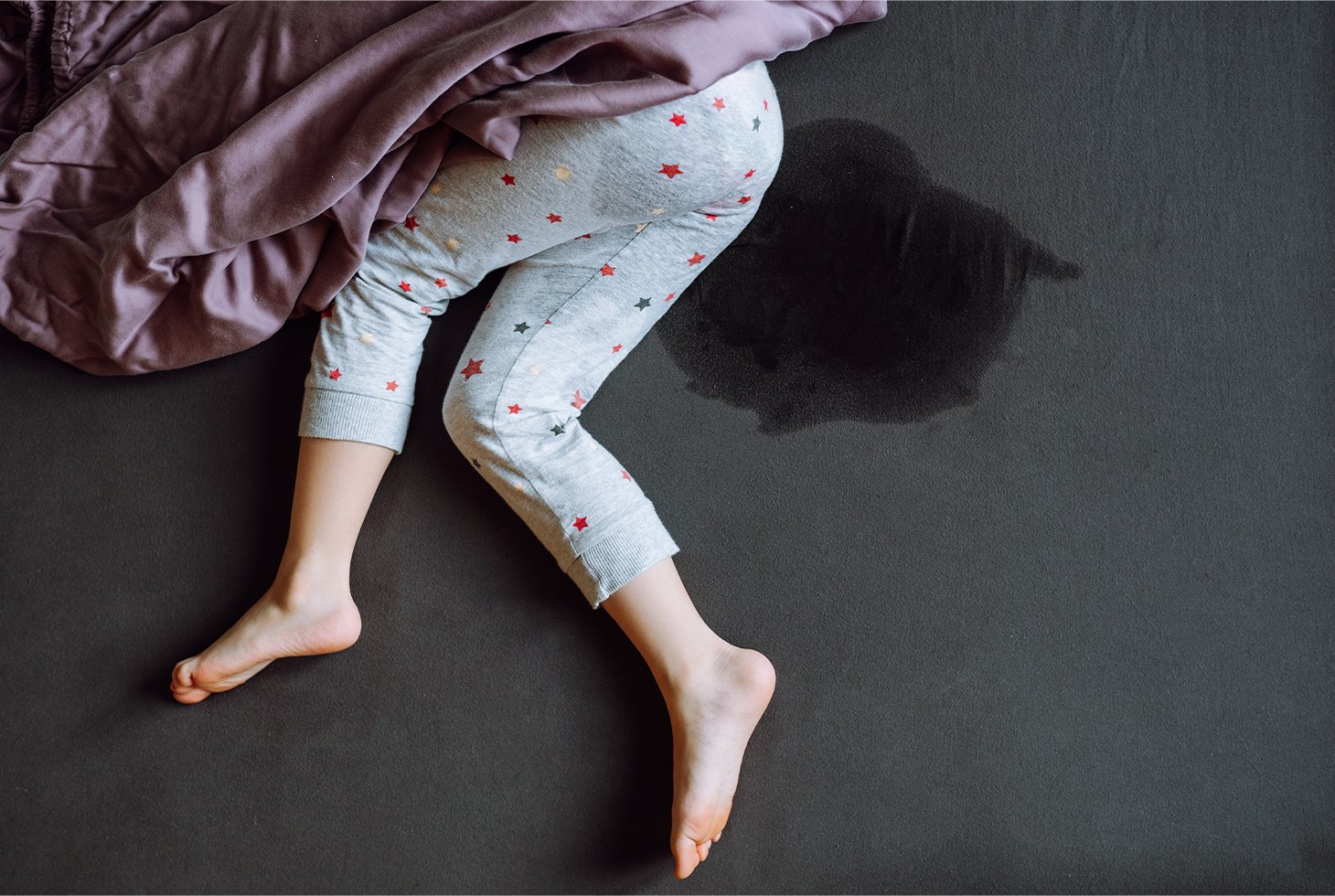 Photo cadrée sur les jambes d’un enfant en pyjama allongé sur un matelas avec une tâche humide pour illustrer l’énurésie infantile.