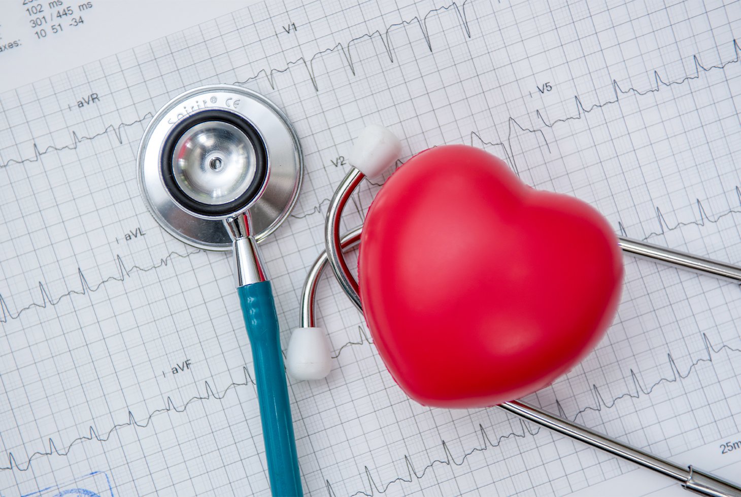 Représentation conceptuelle d’un cœur accompagné d’un stethoscope. Les deux objets sont posés sur une feuille de papier millimétré présentant les résultats d’un ECG.